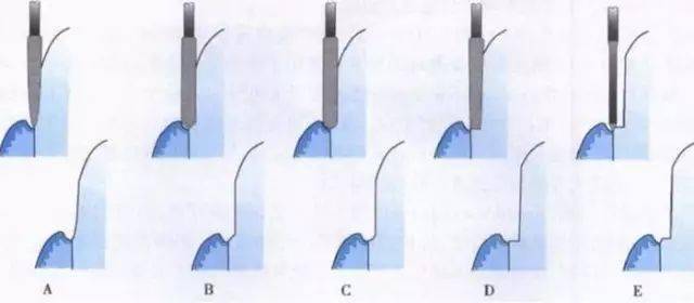BJL平台集团|
种种边缘设计的优缺点(图2)